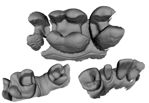 3D_tooth_1